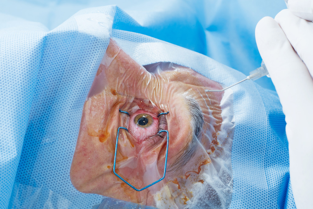 patients comparing cataract surgery providers in Houston
